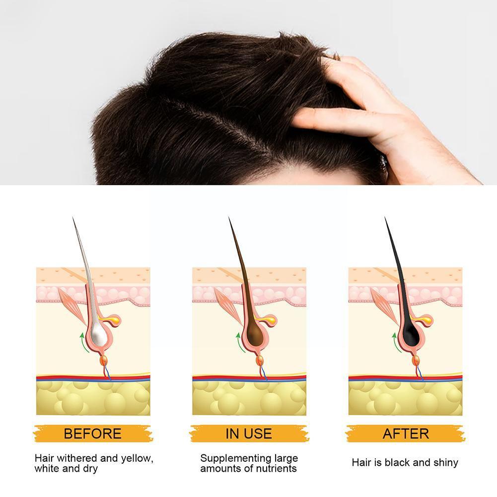 Natural Grey Hair Removal Soap